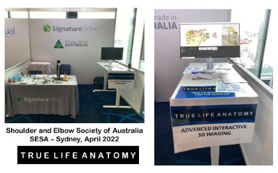 TLA 3D interactive software launches at SESA Shoulder and Elbow Society of Australia